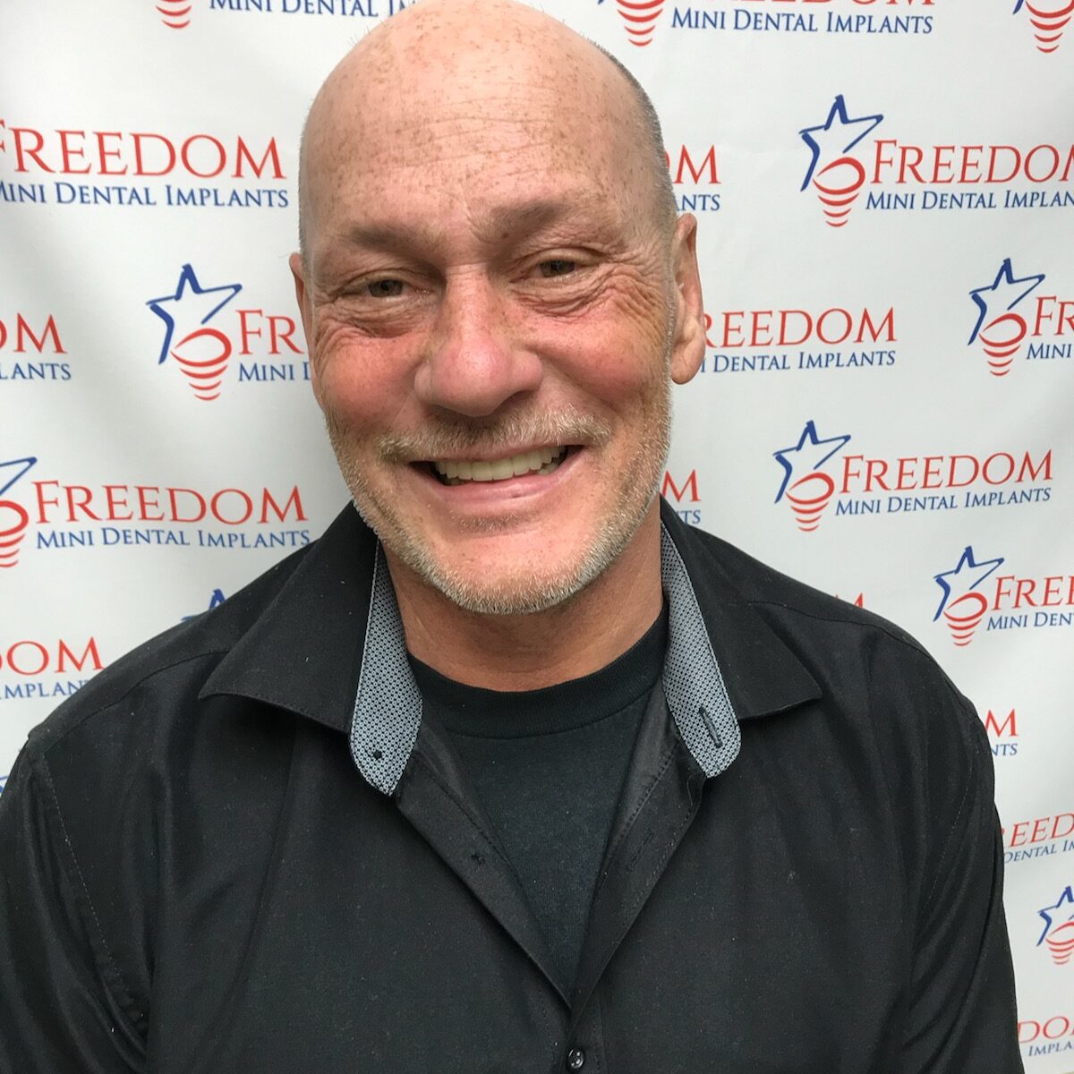 Home Dr. Regan Ackerman. Freedom Mini Dental Implants. Mini Dental Implants in Louisville Kentucky 40291